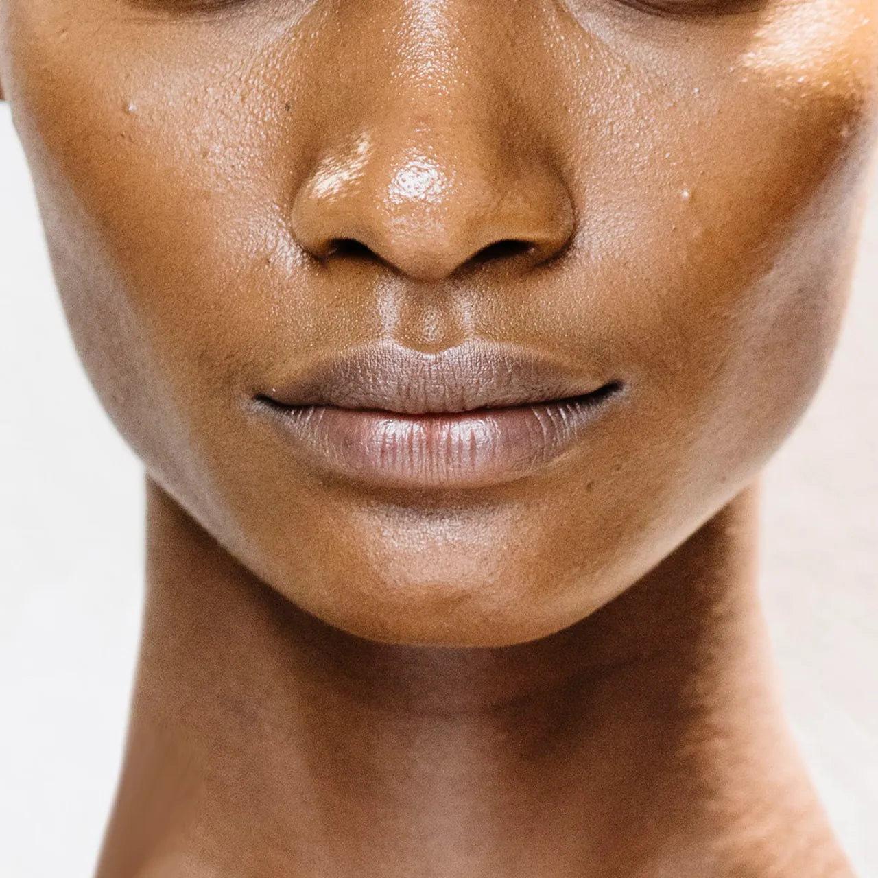 2ml Cheeks Filler