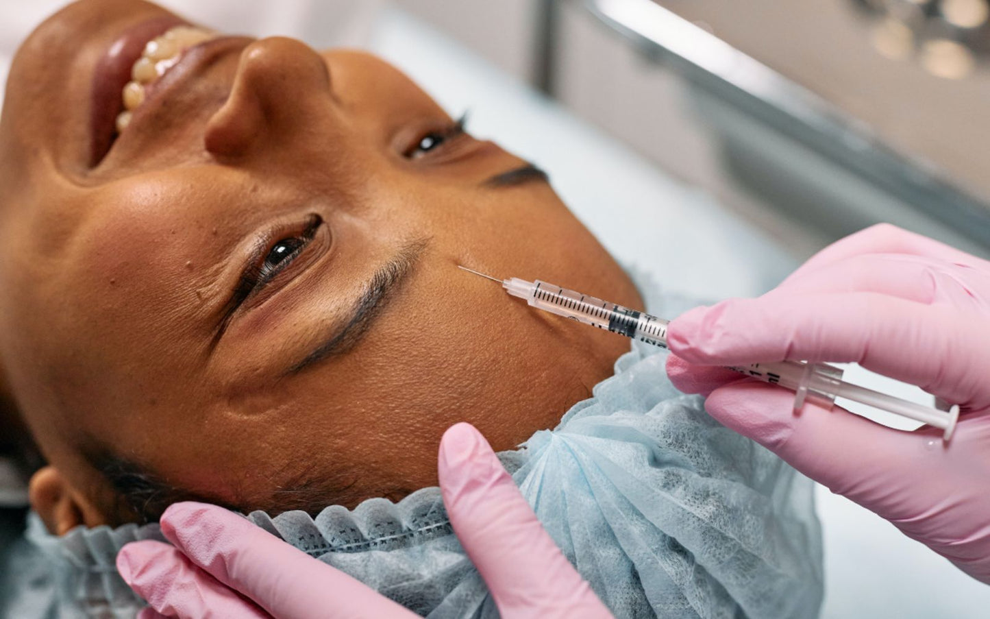 5 Area Botox